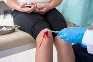 Cuts, Scrapes, and Gashes ER or Urgent Care?