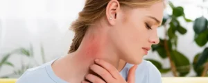 image of a woman scratching her neck because of allergic reactions