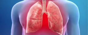 image showing a blue scanned imae of lungs representing pneumonia problem