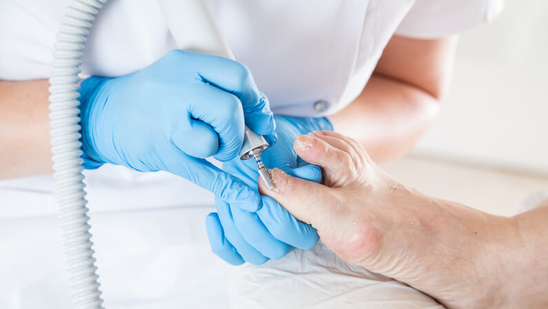 How to Treat infected ingrown toenail