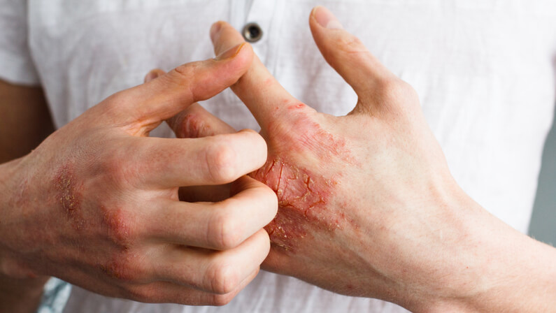 10 Signs When to Worry About a Rash