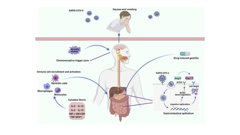 COVID and Gastrointestinal Symptoms: Are They Related?