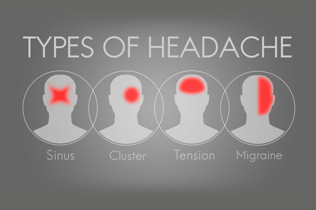 types of headaches