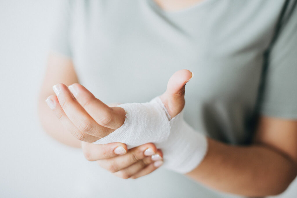 Burns Emergency Care
