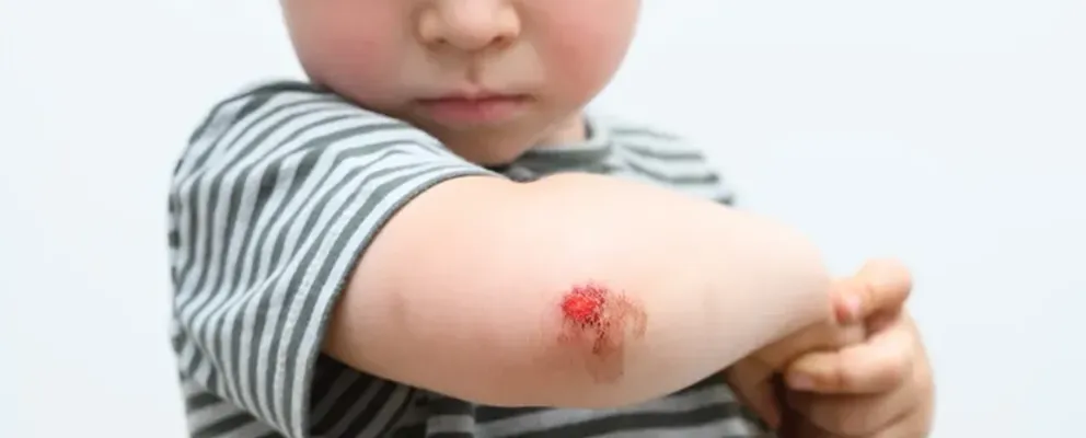 image showing a kid having laceration problem and suffering very much.